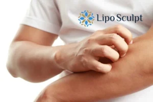 Best Actinic Keratoses Removal 4 prevent your actinic keratoses Beaumont Leys getting worse - call our team today!
