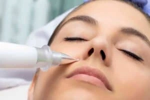 Best Actinic Keratoses Removal 3 Actinic keratoses Beaumont Leys solutions - book in today!