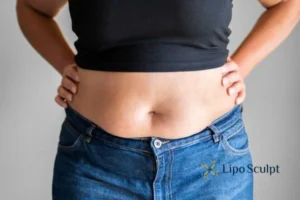 Bidding Farewell to Muffin Tops with Aqualyx Fat Injections 2 Do you wish you could reduce your muffin top Beaumont Leys With Aqualy fat dissolving injections you can!