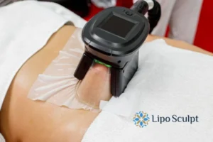 Does Fat Freezing At Home Work? 3 Fat freezing at home from Lipo Sculpt Beaumont Leys